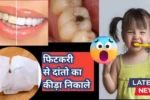 Remove yellow teeth with Alum