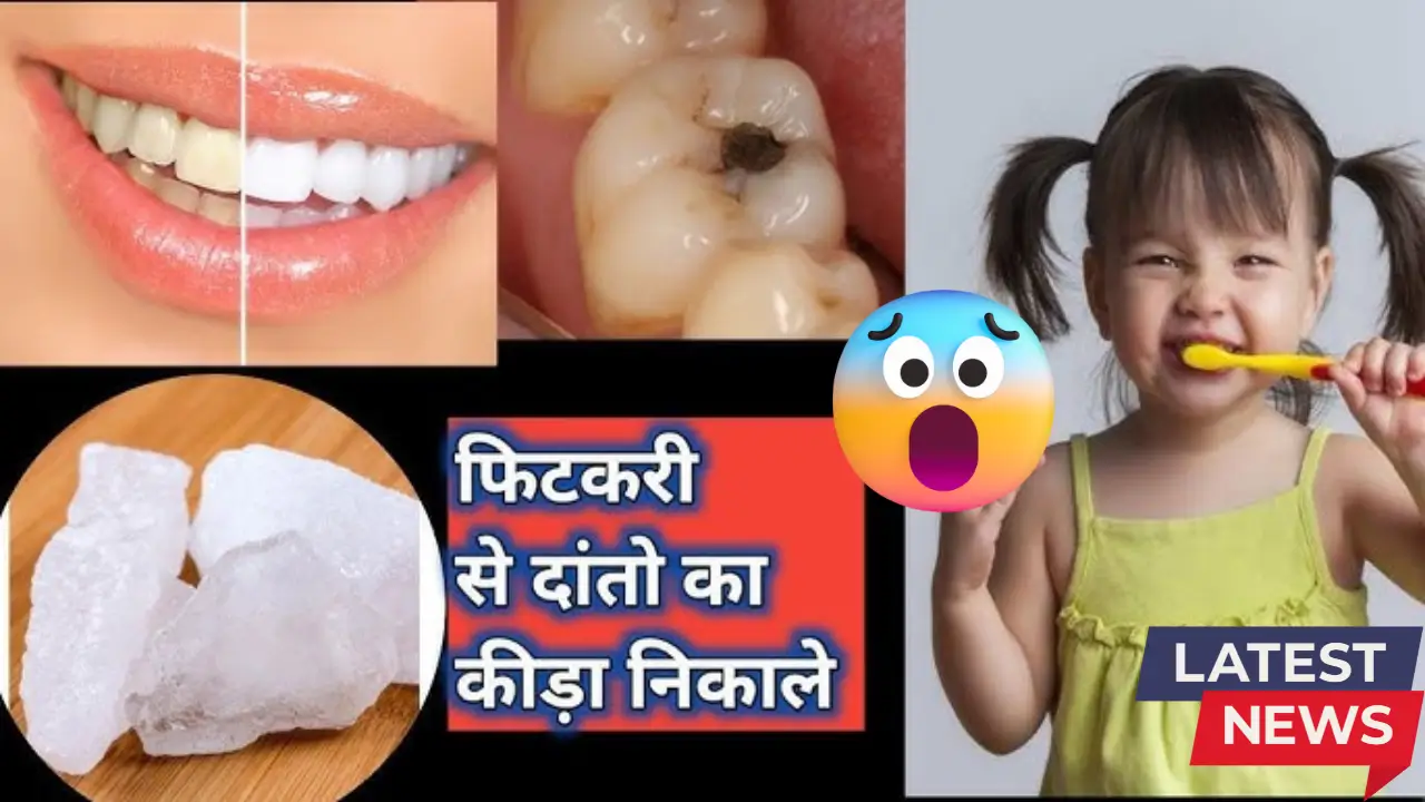 Remove yellow teeth with Alum
